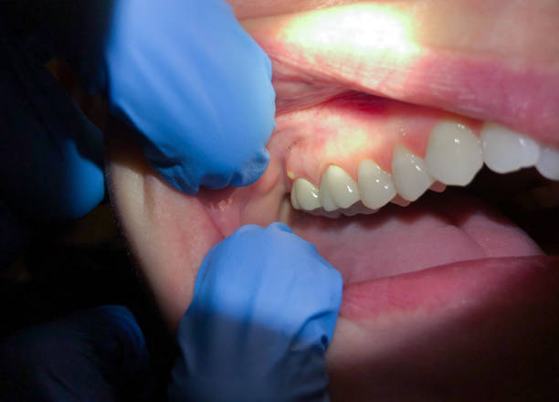 Best Walk-In Emergency Dental Services in Belmont, NC